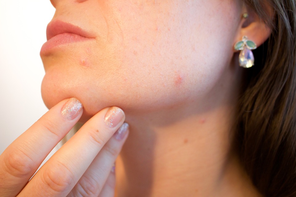 Too much iron may cause skin infections